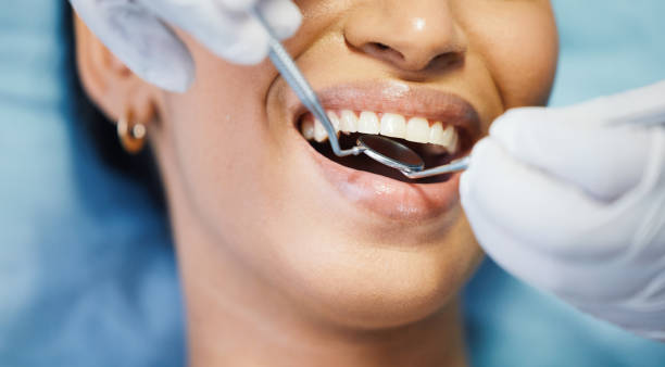 Best Emergency Treatment for Dental Infections or Abscesses in Meridian, CO